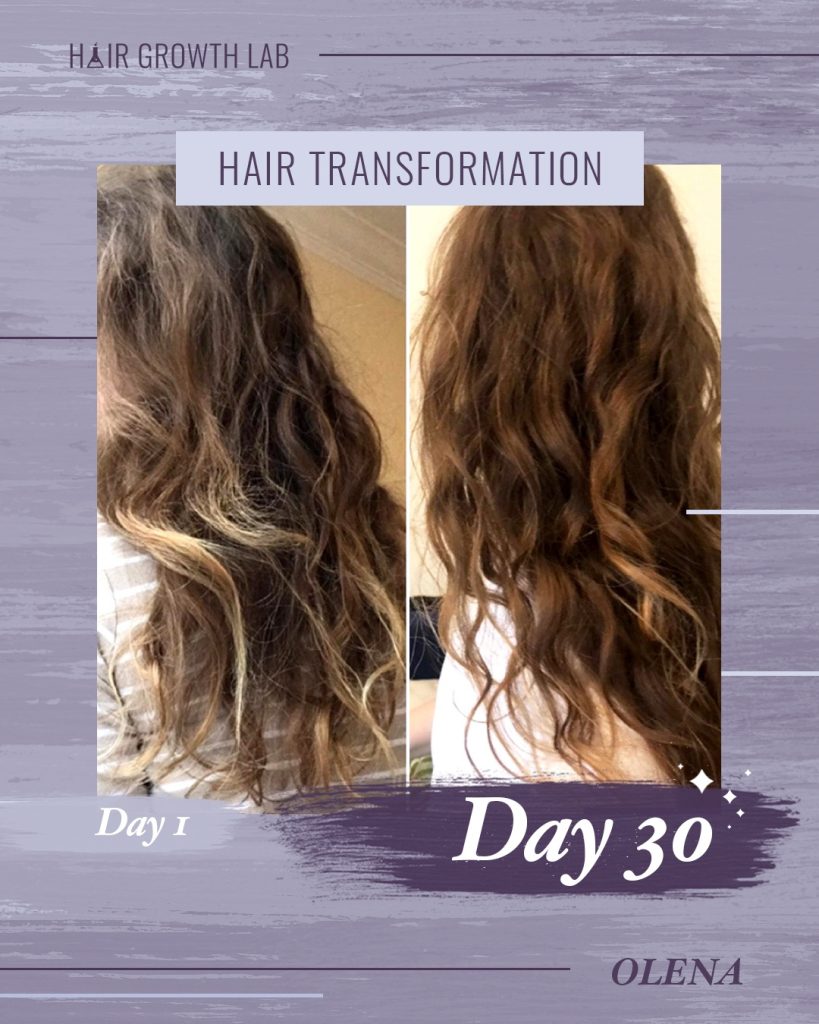 Success Stories of Hair Regrowth Naturally : Transformative Testimonials